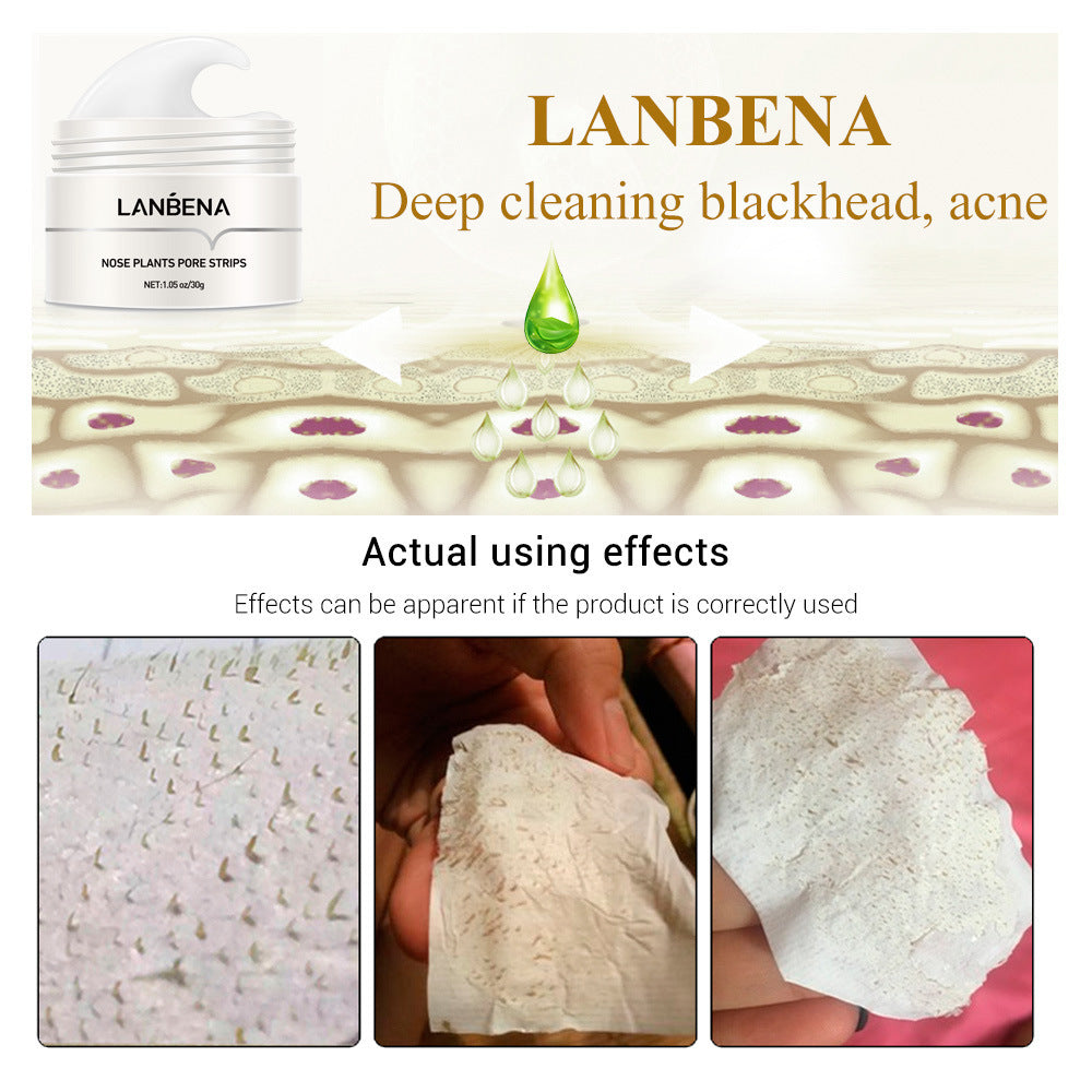 Blackhead Removal Nose Strips + Cream Set