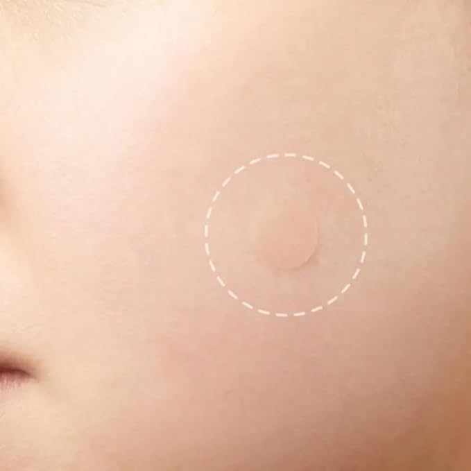 Acne Patch